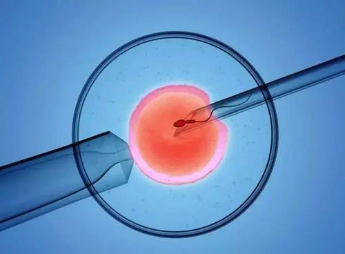 美国试管婴儿囊胚移植后白带增多正常吗？