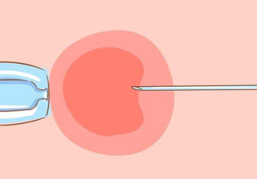 试管婴儿成功率的关键因素是什么