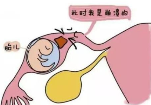 试管婴儿步骤过程详细