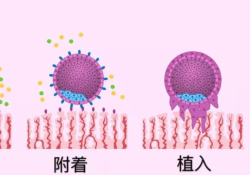 俄罗斯试管靠谱吗胚胎冷冻？​
